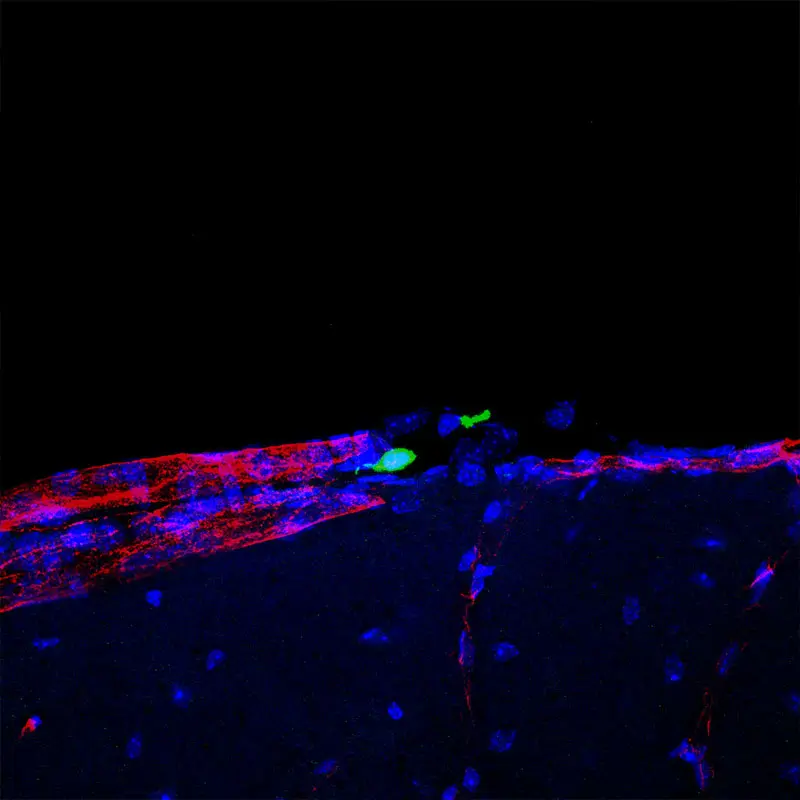 Peripheral monocytes accumulate in the meningeal space. (Created by Flurin Cathomas, MD, postdoctoral fellow, and Carrie Hsiao-Yun Lin, visiting postdoctoral fellow, Russo lab.) 