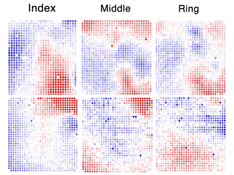 Middle Right. Somatosensory evoked potentials corresponding to individual finger stimulation confirm overlapping but distinguishable regions of primary somatosensory cortex most responsive to stimulation of the index, middle, and ring fingers. Red represents positive surface voltage, blue represents negative voltage. Each dot represents a single 50 µm electrode, with inter-electrode spacing of 400 µm. The arrays are positioned as shown in the intraoperative image in top right. 