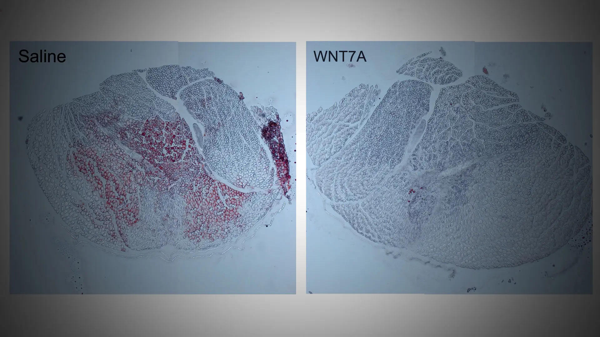 New Therapeutic Could Prevent Rotator Cuff Muscle Degeneration