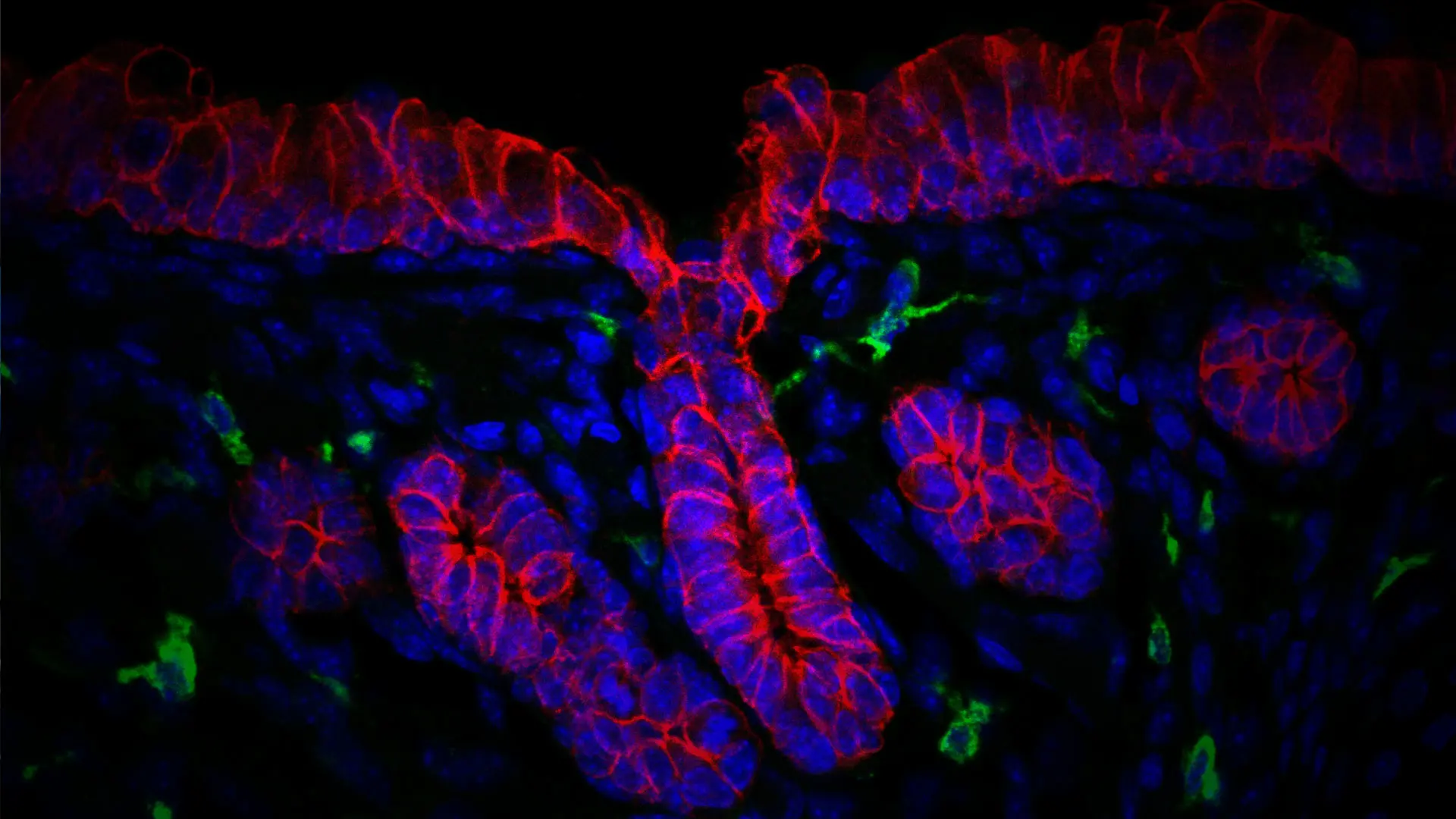 Investigating the Role Macrophages Play in the Formation of Healthful Respiratory Submucosal Glands