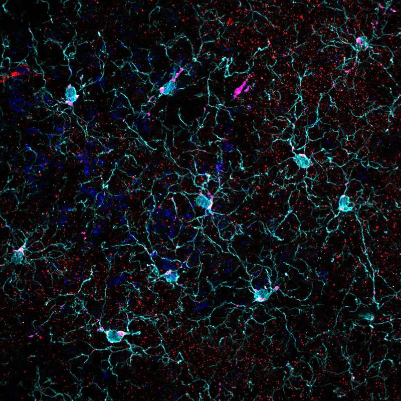 Microglia mediates synaptic pruning. (Created by Carrie Hsiao-Yun Lin, visiting postdoctoral fellow, Russo lab.)