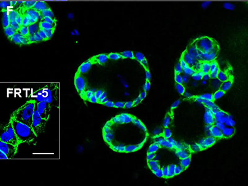 The differentiated cells formed three-dimensional thyroid follicles, shown expressing the thyroid-specific gene TSHR (green) in the membrane. The inset shows staining of rat FRTL-5 thyroid cells.