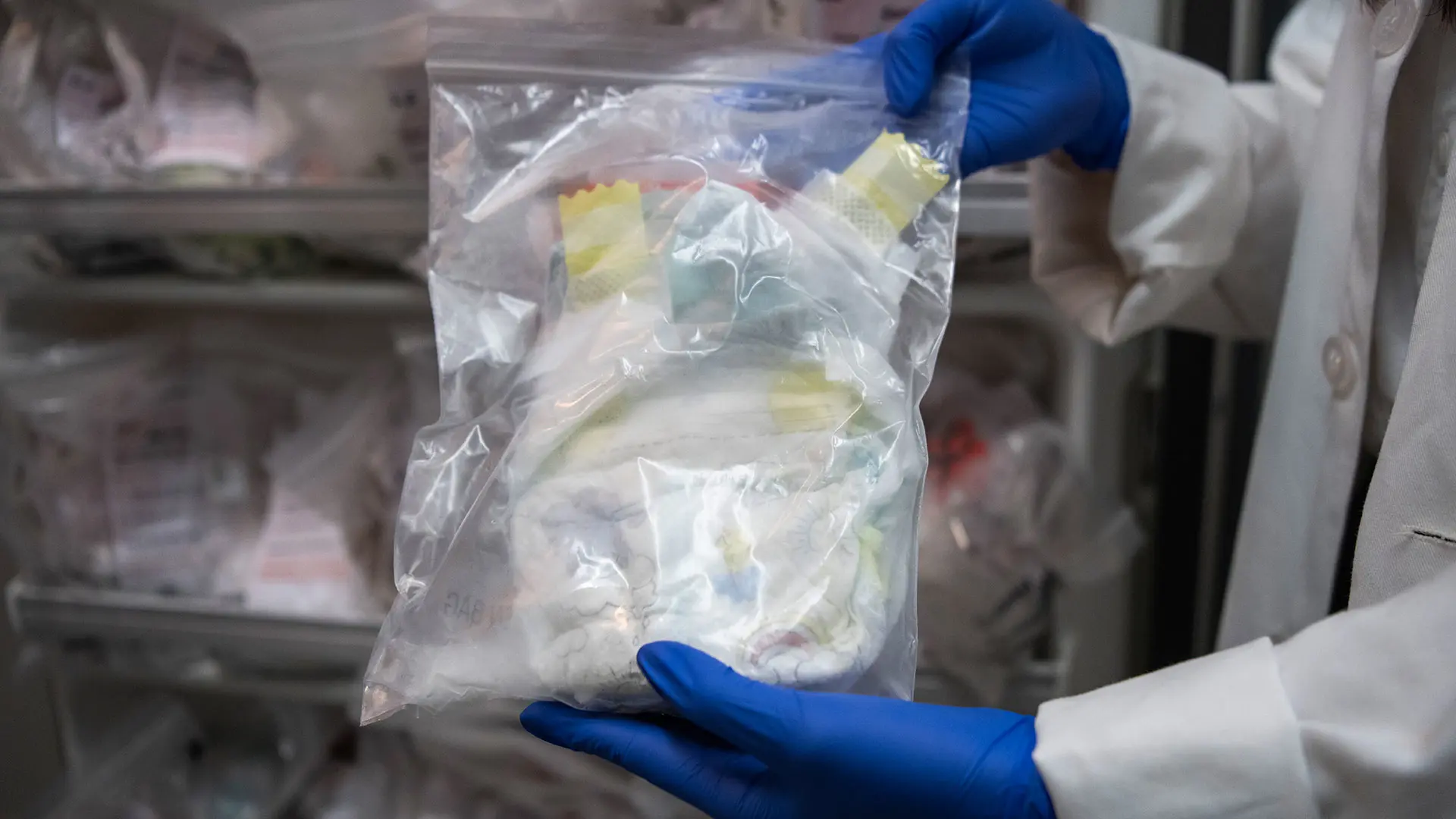 Microplastics come in many different forms but are ubiquitous in the environment, are frequently ingested, and have significant implications for gastrointestinal health.