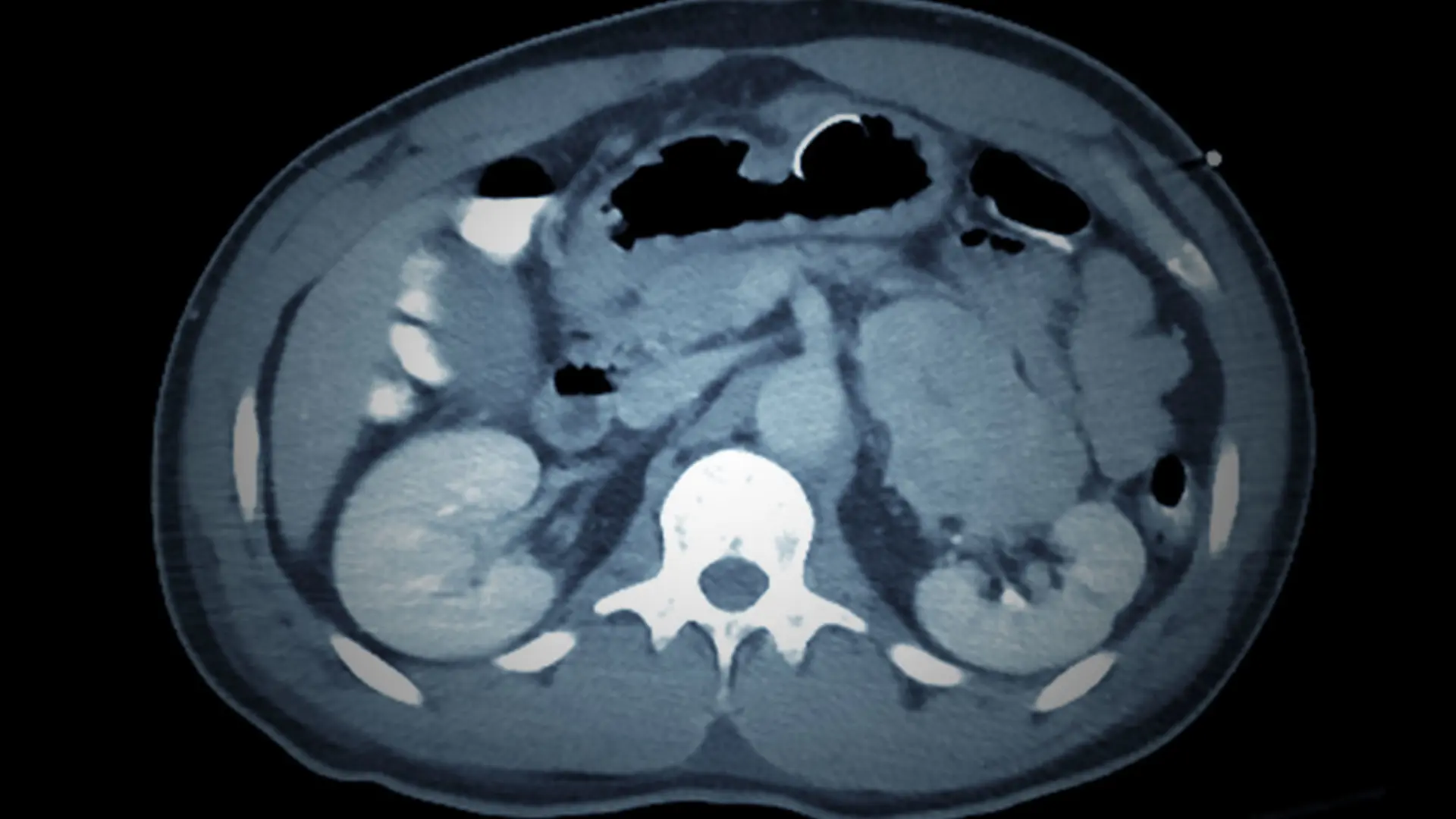 Endocrinology, Diabetes and Bone Disease 2025