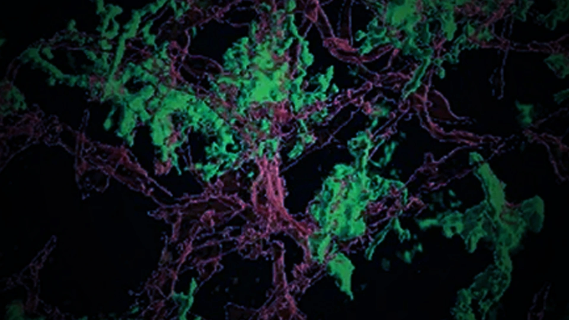 Microglia Could Be The Key to Slowing Invasion and Relapse in Glioblastoma