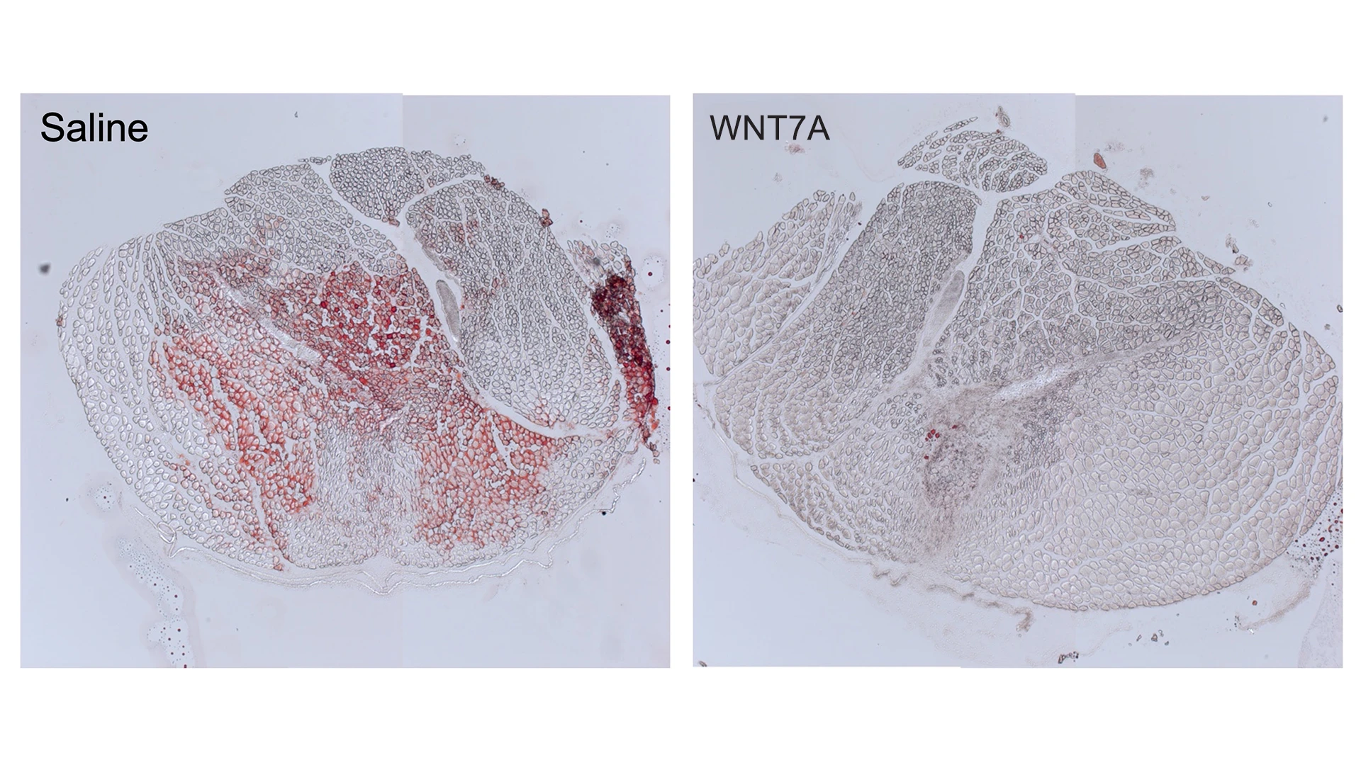 WNT7A injection significantly reduces intramuscular fatty infiltration in a proof-of-concept mouse model. Red (Oil Red O) staining indicates fat.