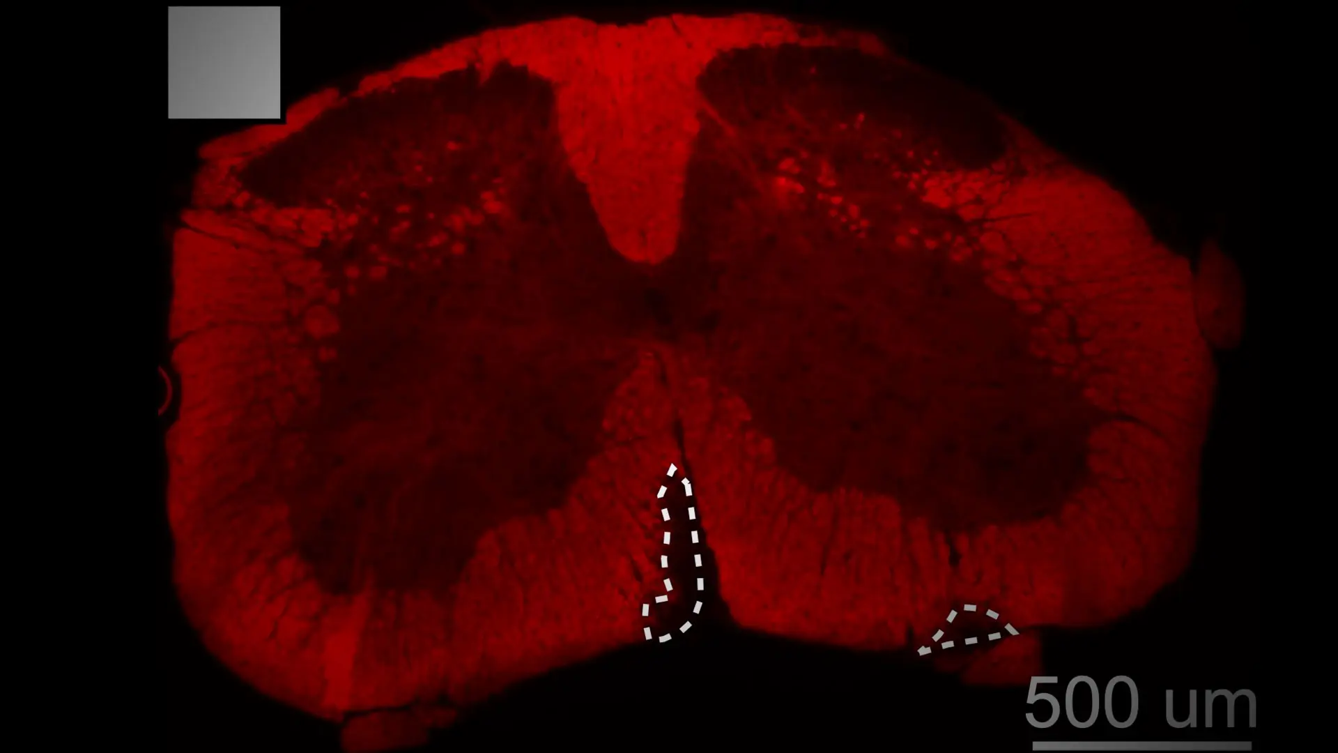 Research Roundup: CVRI Made Insights Into Heart Regeneration and Role of Immune and Metabolic Processes in Heart Health
