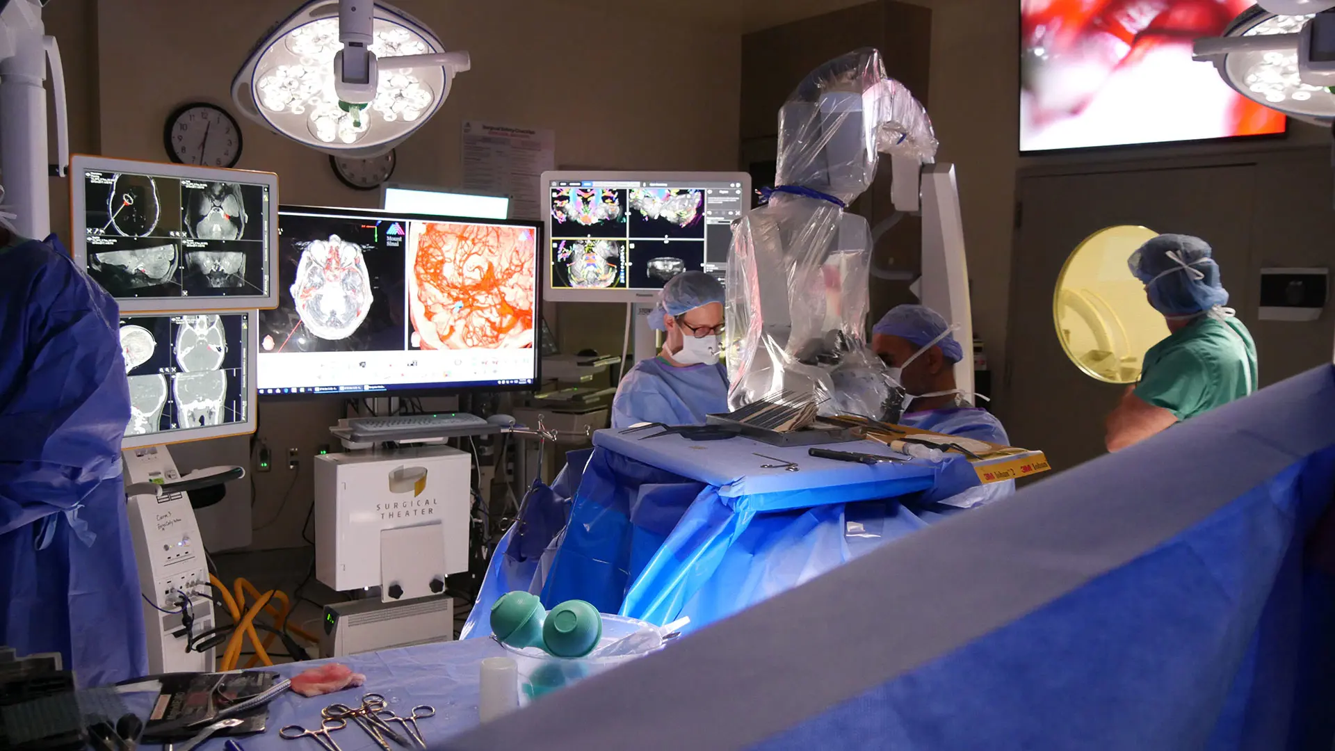 Anatomic visualization of cranial nerves from 7-Tesla MRI in the operating room.

