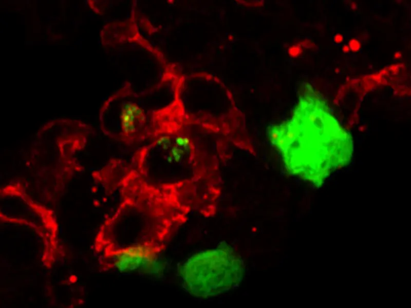 Tissue resident macrophages, in red, are shown eating tumor cells, in green.  



