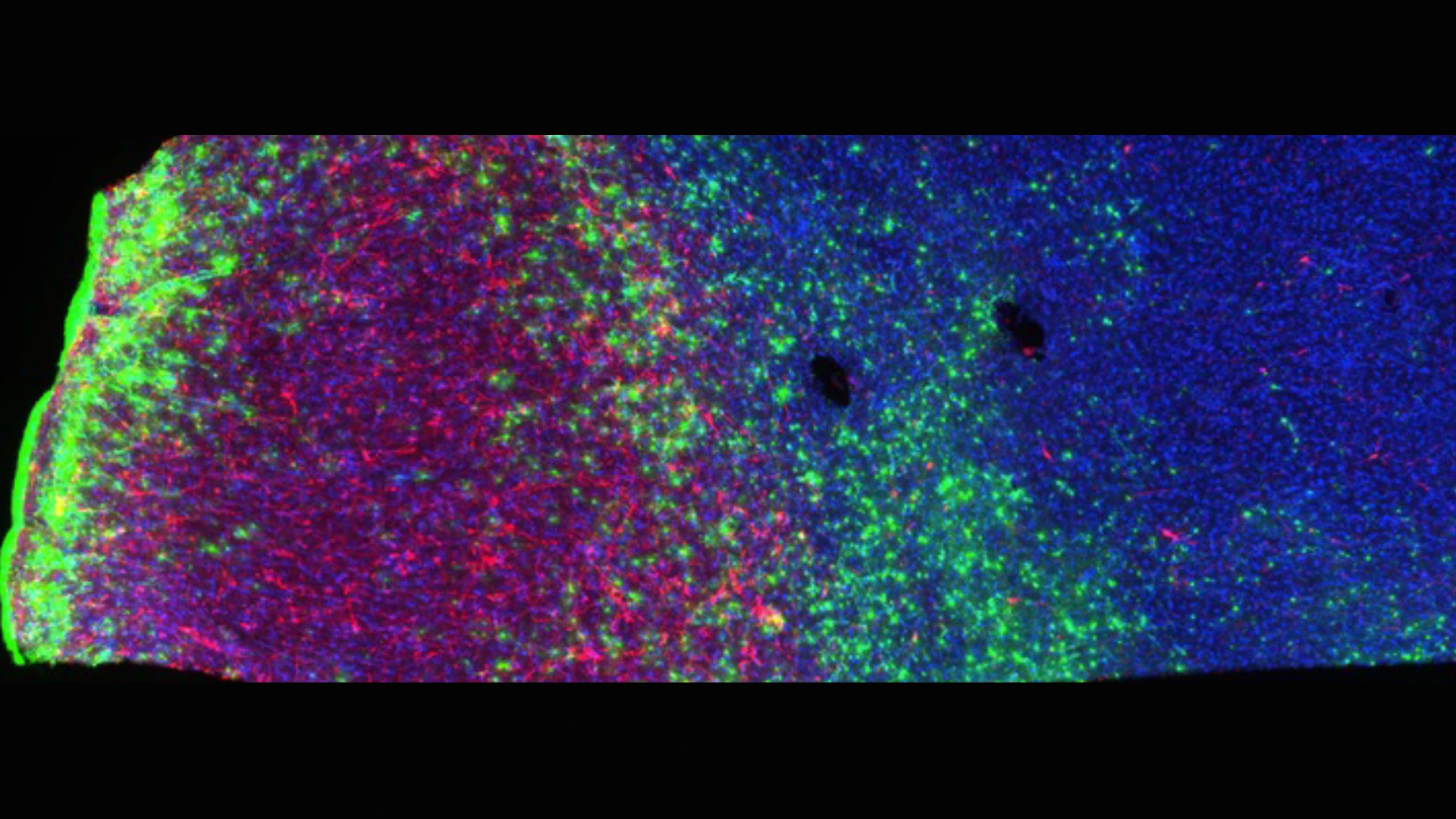Figure 3. Stained human brain tissue showing neurons (red), astrocytes (green), and microglia (blue). This NIH-funded project is an ambitious attempt, for the first time, to map all the cells in an entire human brain.