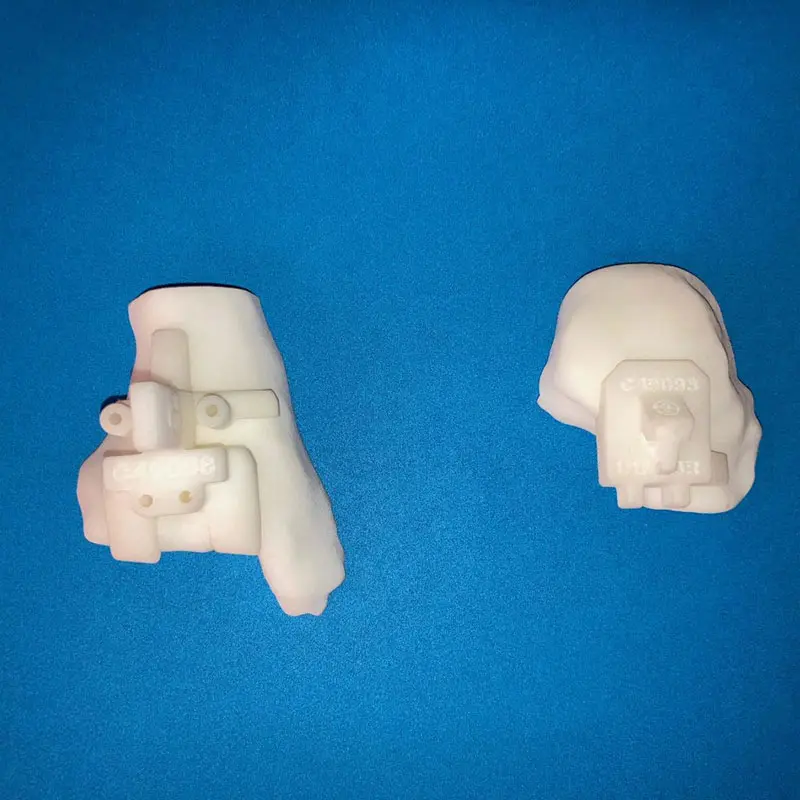 3D-printed jigs for placement of tibial and talar cutting guides for a total ankle arthroplasty positioned on 3D-printed tibia and talus pieces based on preoperative CT scan.