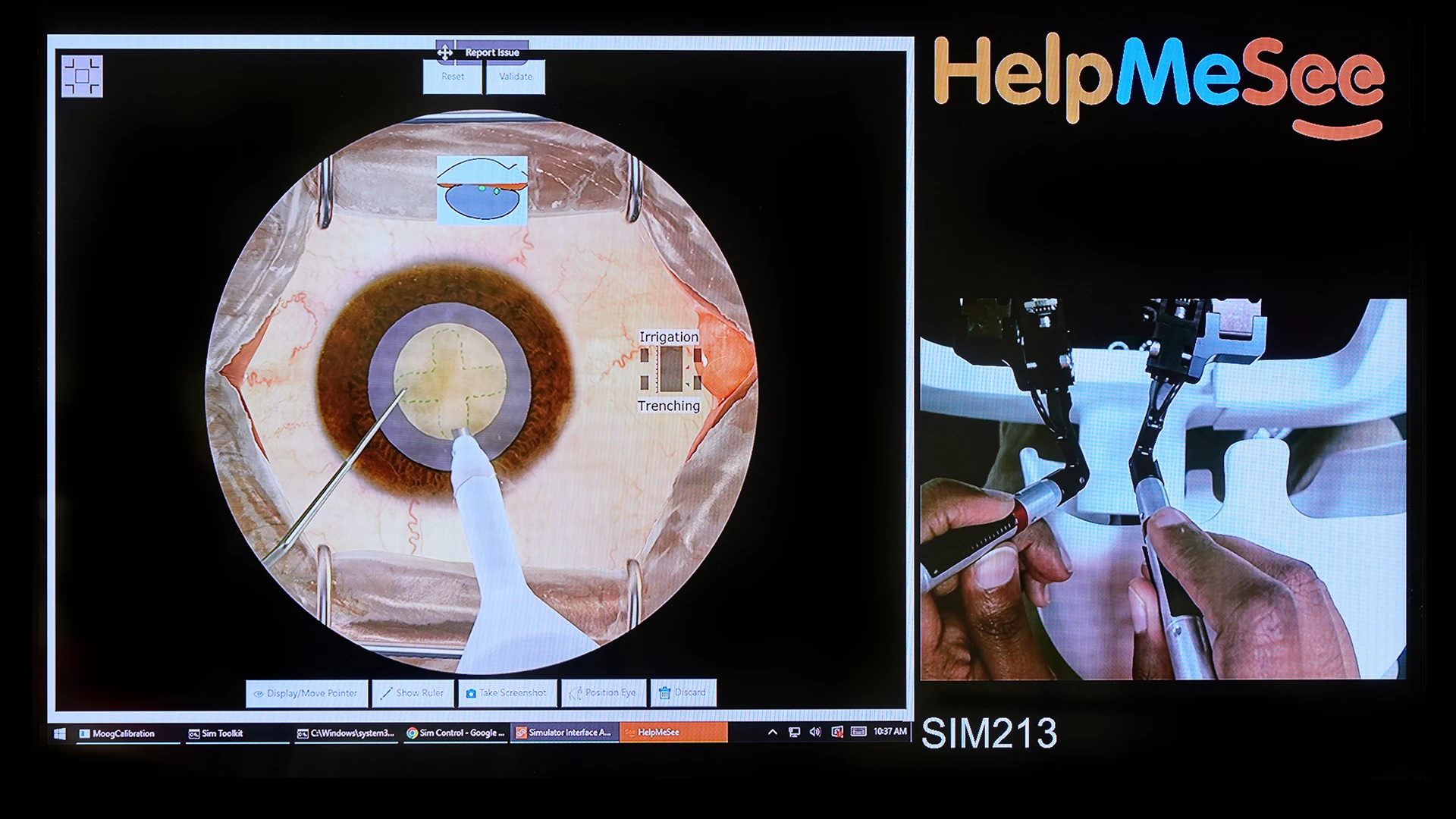 Simulation of emulsification of the nucleus using phaco