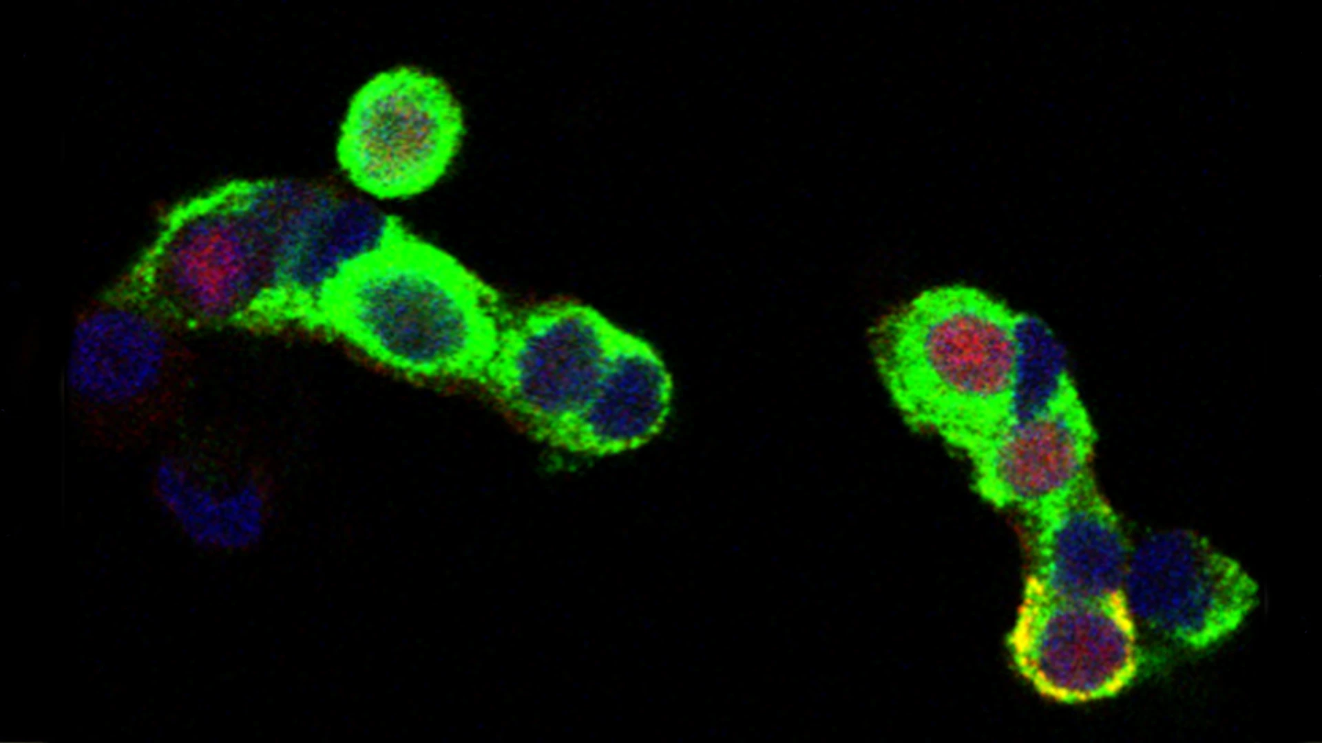 Immunostaining shows expression of p57KIP2 (red) in approximately 50 percent of human beta cells (green).
