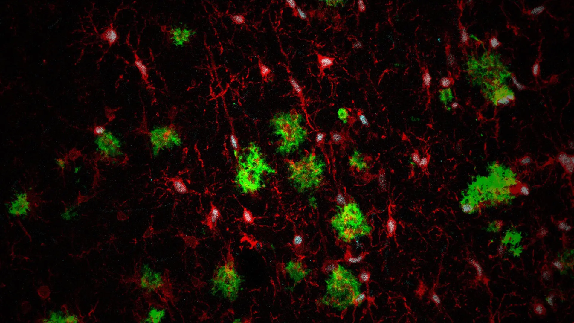Genetic Pathways to Alzheimer’s Disease: Risk, Protection, and Great Potential for New Therapies