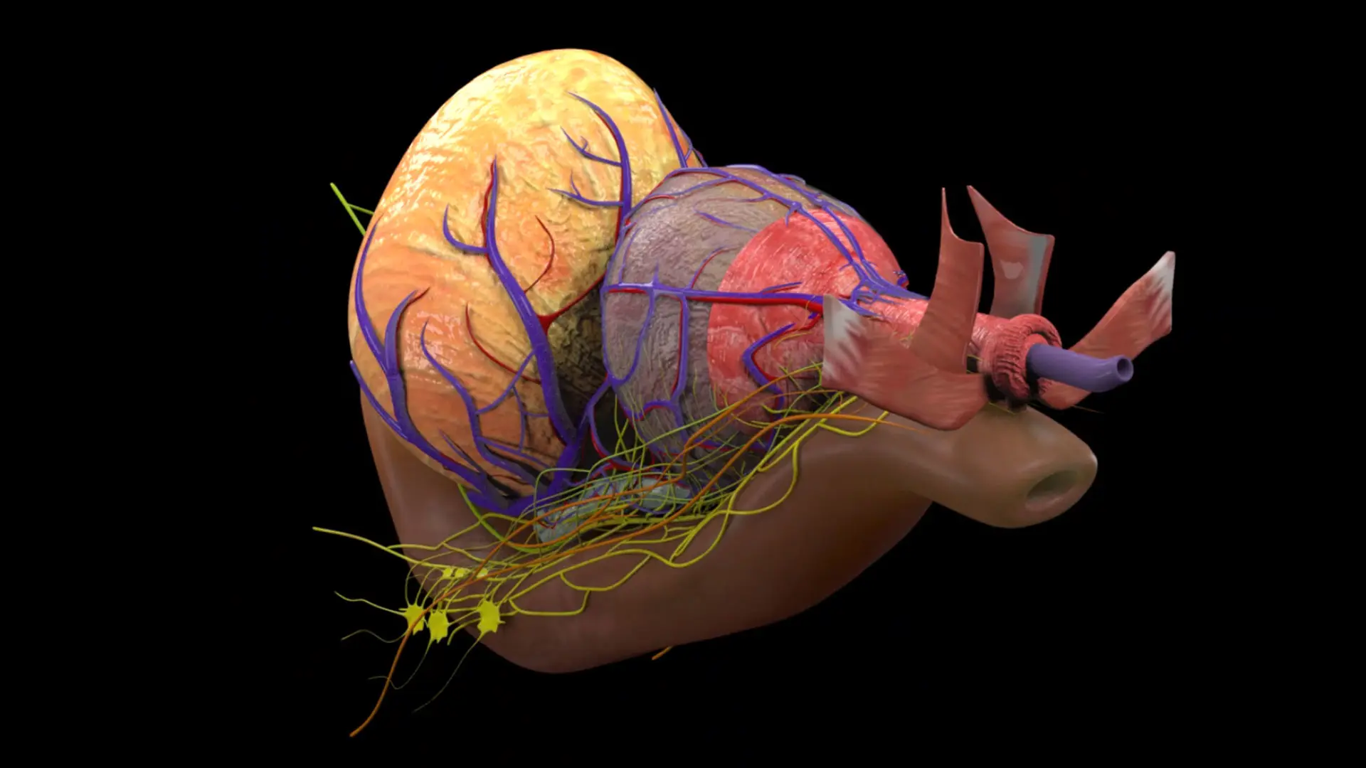 Artificial Intelligence Is Reshaping Prostate Cancer Care, and Mount Sinai Is Leading the Way
