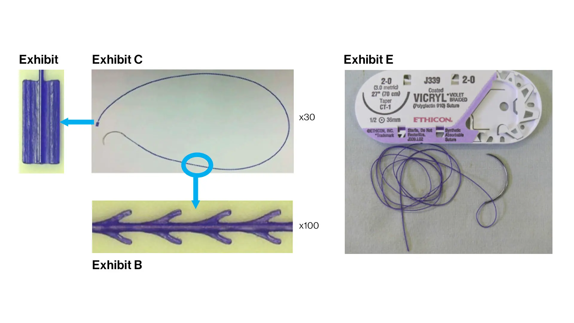 The Stratafix® barbed suture, left, and the Vicryl® (Polyglactin 910) suture. 