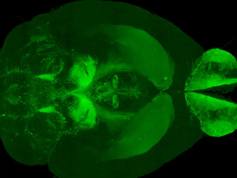 3D imaging of dopamine neuron distribution in a whole mouse brain (Courtesy of Zhuhao Wu, PhD)