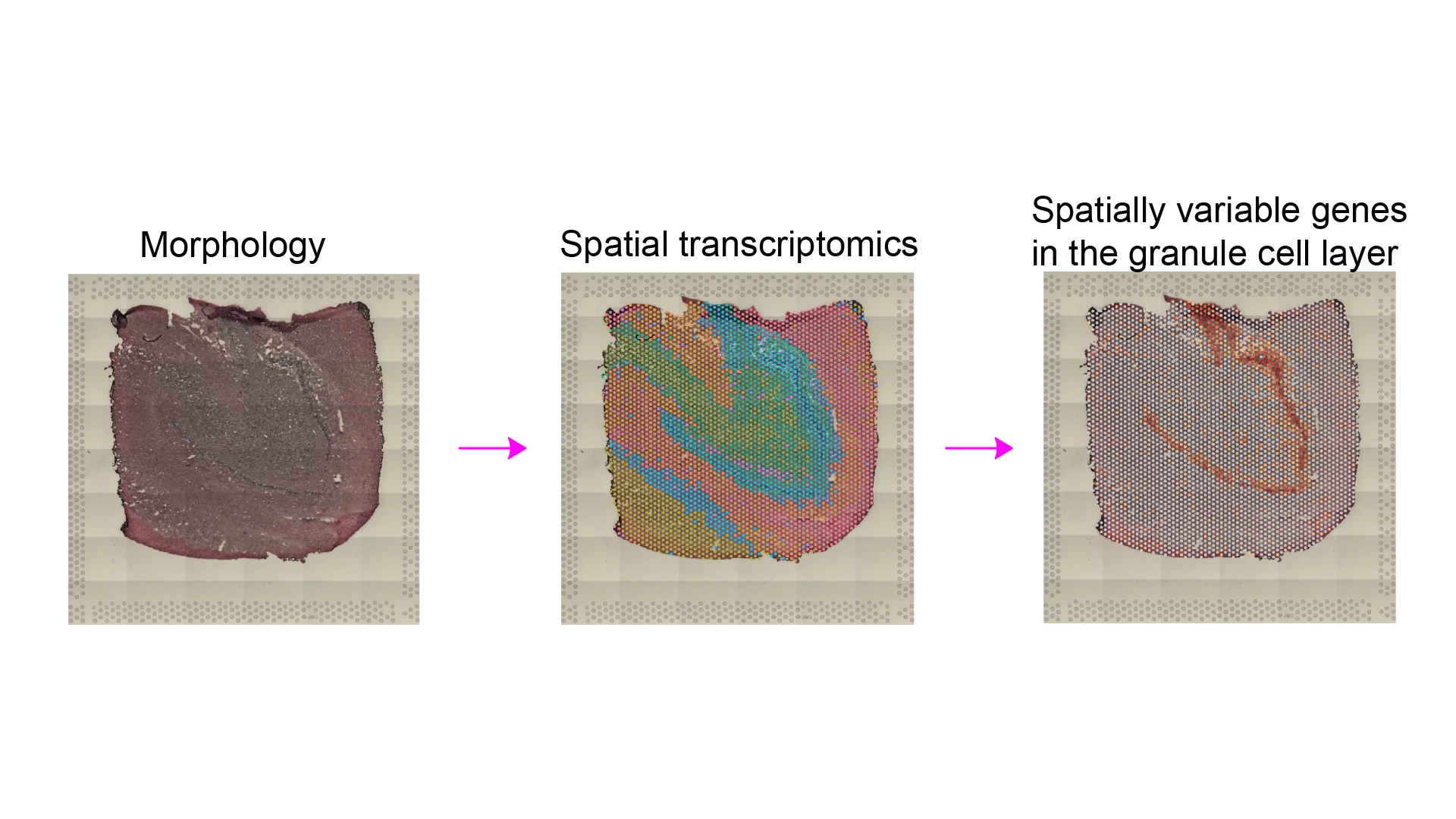 Figure 2. Morphology (H&E staining), spatial transcriptomics using 10x Genomics Visium platform, and spatially variable genes detected in the granule cell layer of the human dentate gyrus.