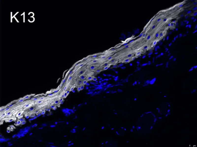 Laryngeal epithelial microarchitecture. Immunofluorescent image of human laryngeal epithelium Keratin 13 (K13) is expressed in more differentiated layers, while K14 is expressed in basal layers.









