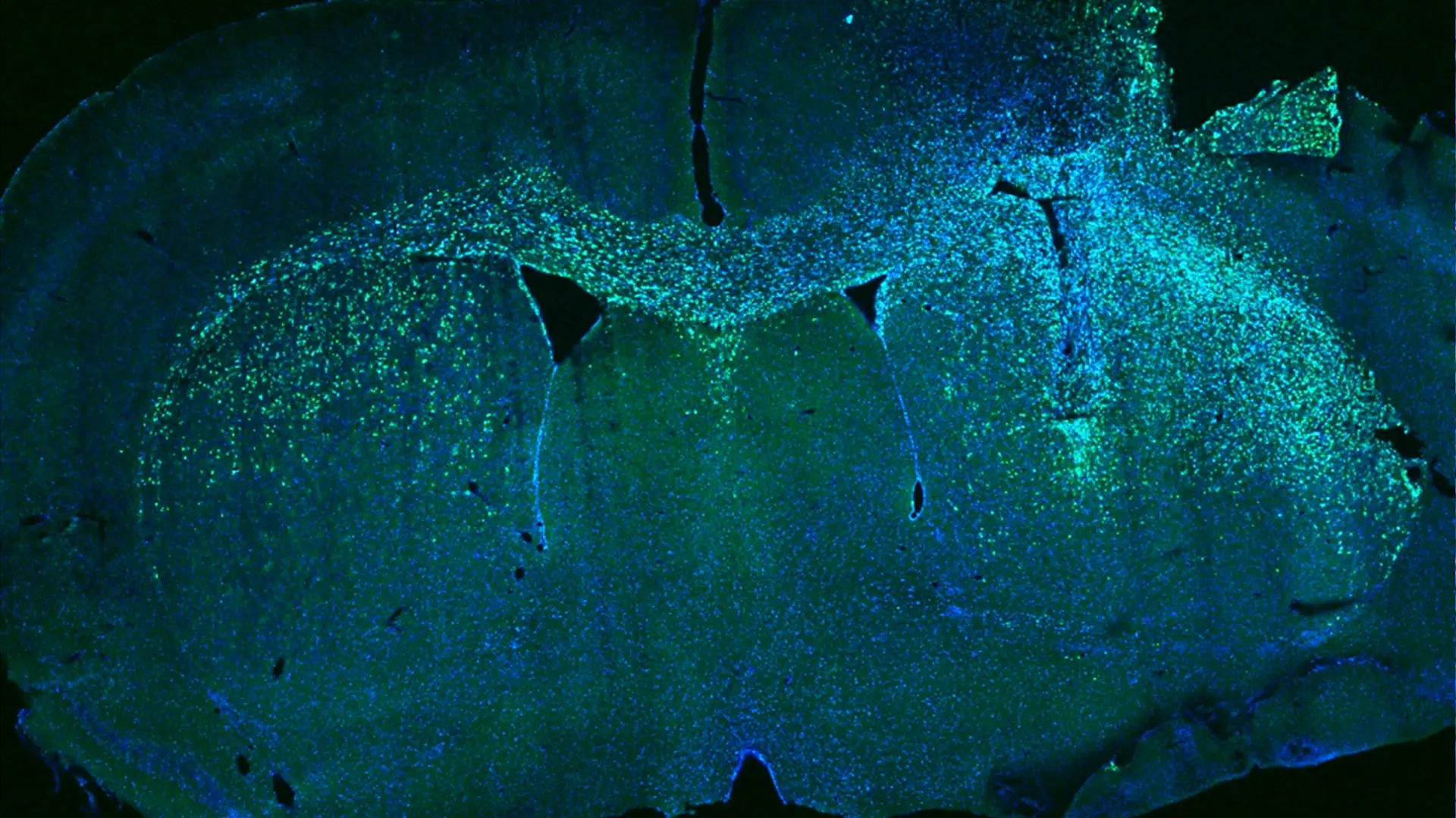 Fig. 1. Human glioblastoma cells were transplanted into the right side of a mouse brain. The glioblastoma cells (green cells in a blue-stained brain section) recapitulate the invasive growth that is seen in patients and have crossed through the midline to invade the left hemisphere.