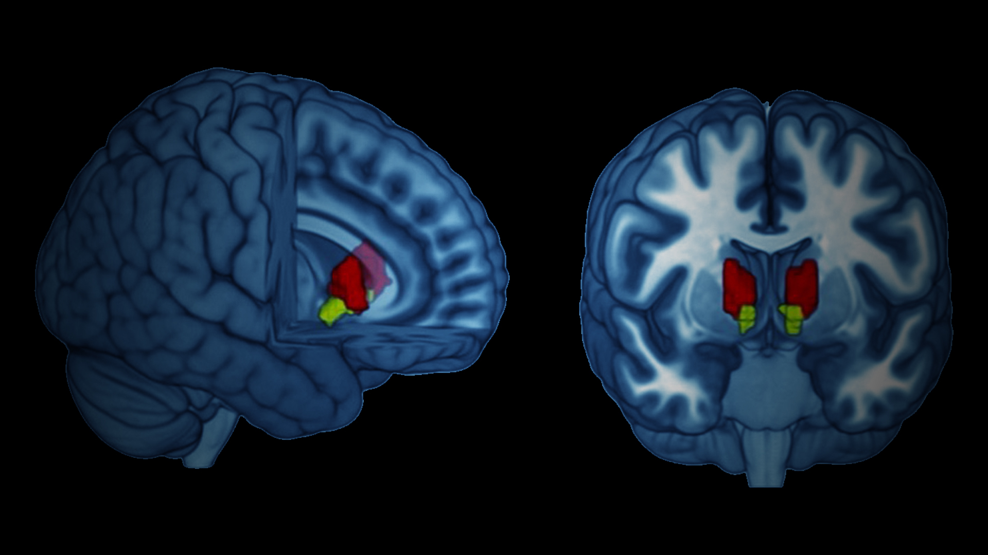 Validating KCNQ as Target for Major Depression Disorder