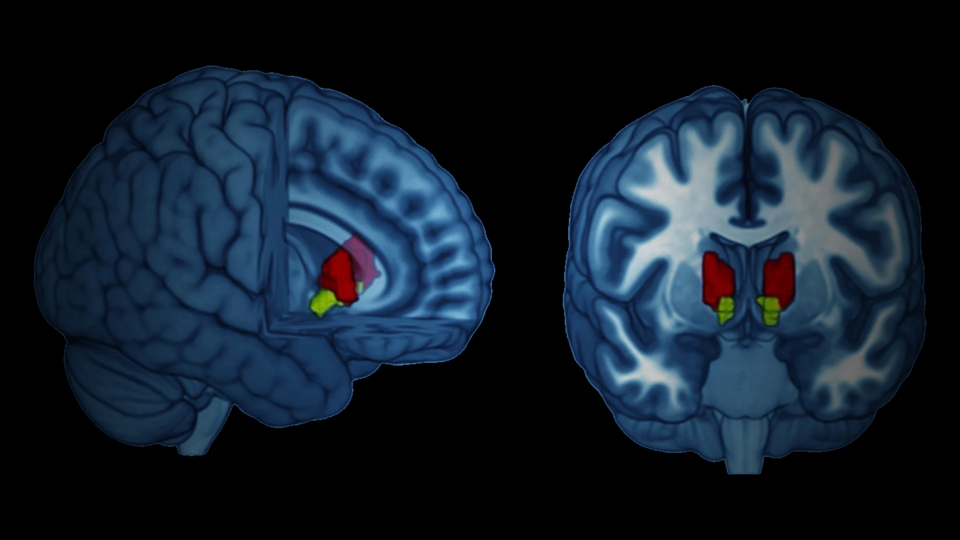 Validating KCNQ as Target for Major Depression Disorder 