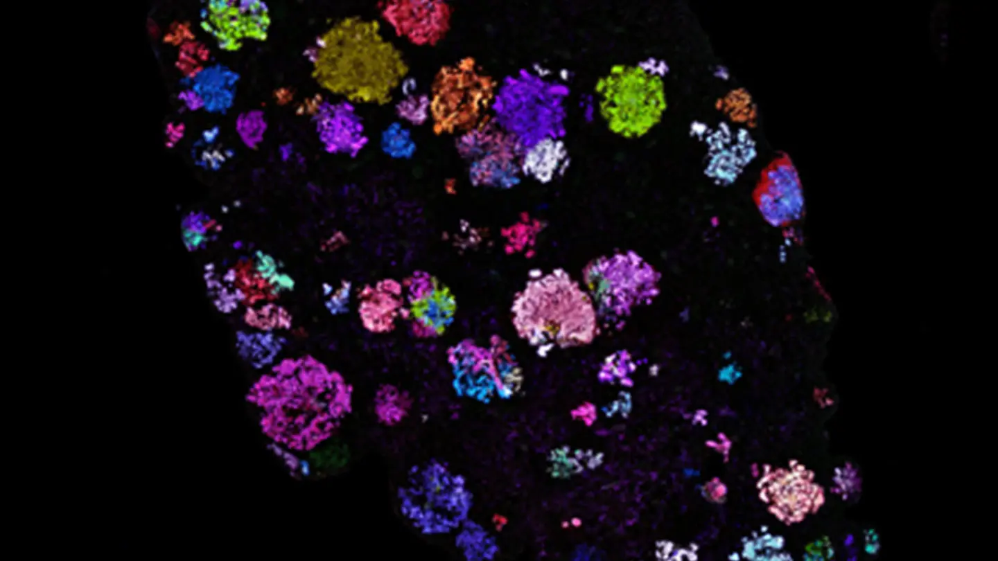 Zeroing in on Genes that Control the Tumor Microenvironment
