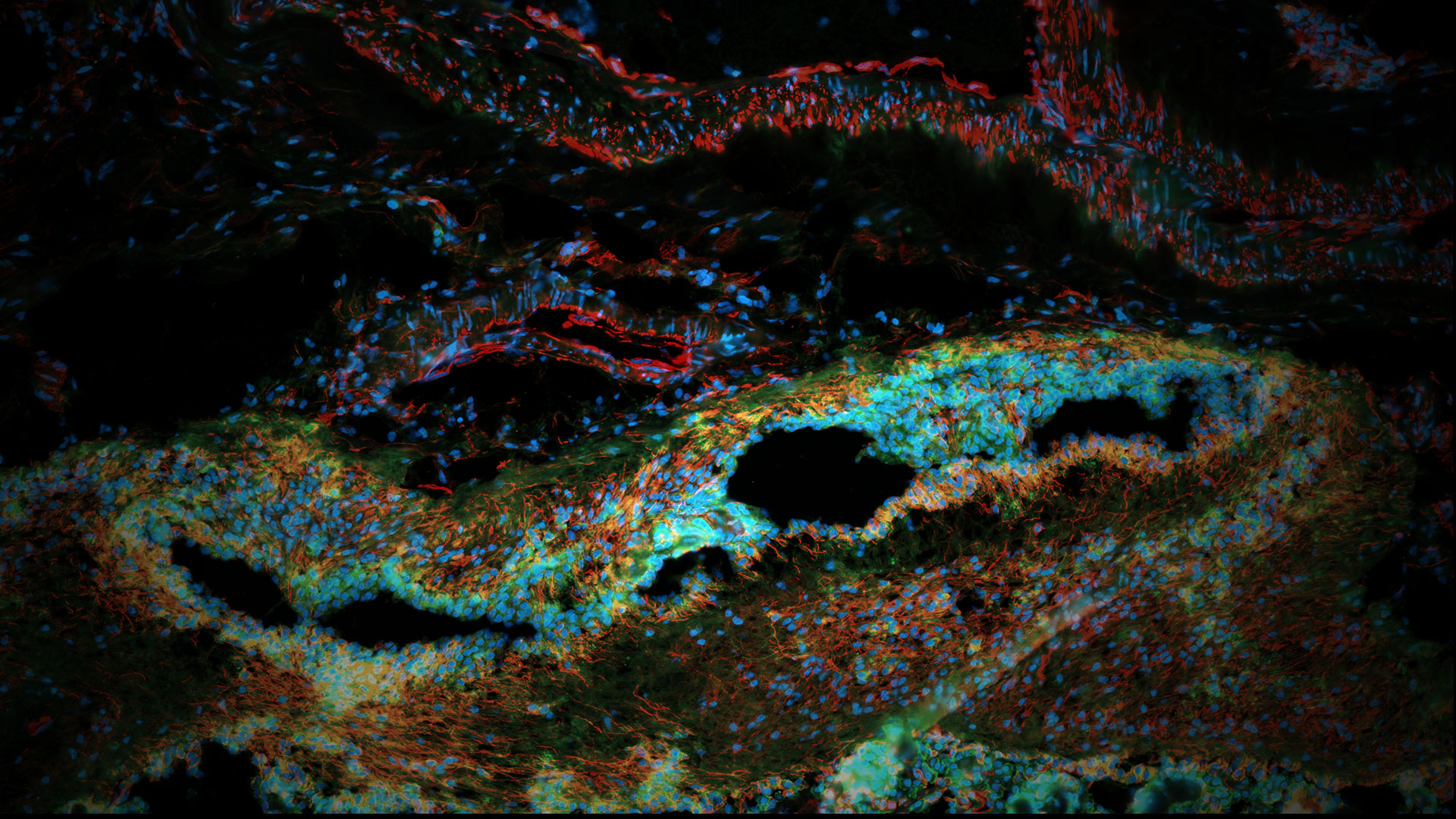 Morphological Masterpiece: Revealing the Intricacies of a Brain