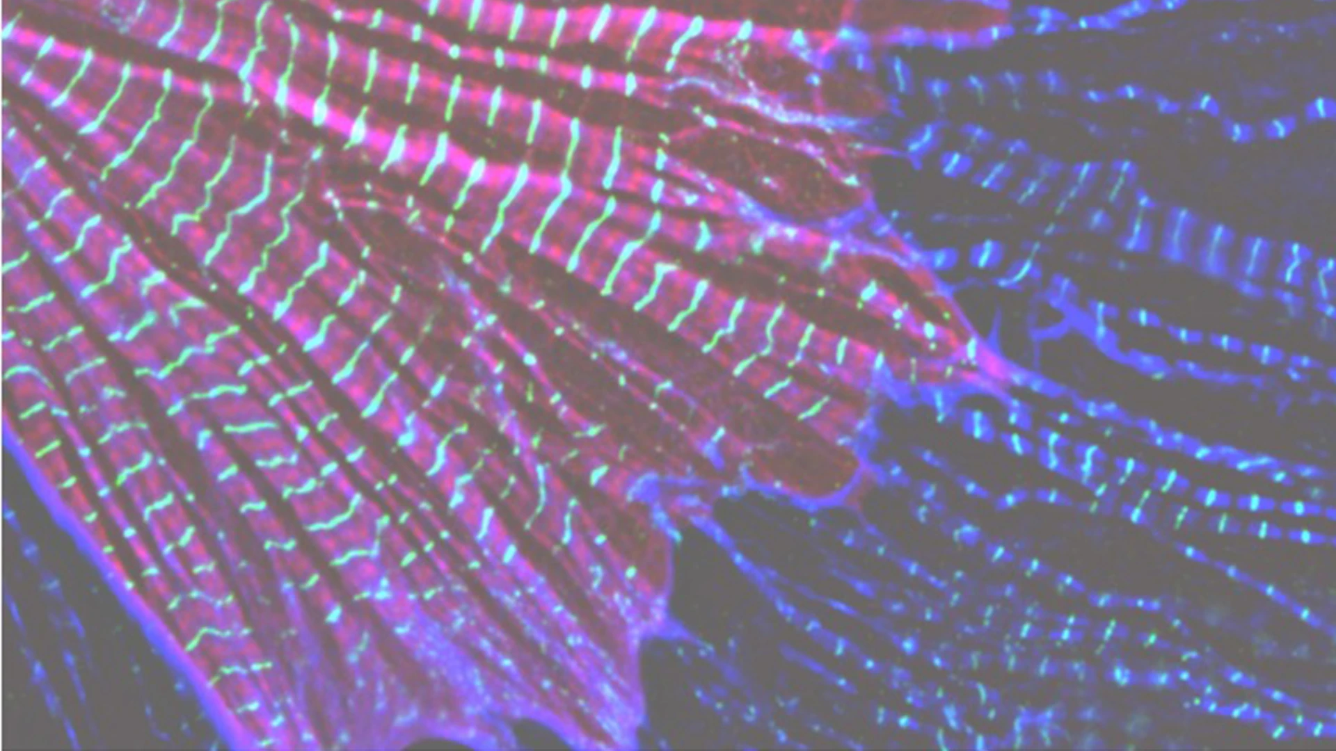  At the subcellular level, sarcomeres are individual units, essential for heart and skeletal muscle contraction. LMOD2 is required for maintaining thin filament lengths. Above is LMOD2 knockout cardiac myocyte, displaying disrupted sarcomere structure. 