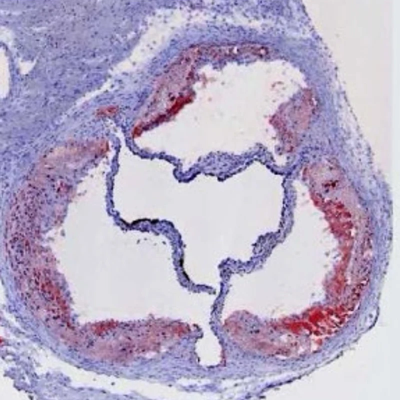 Aortic root cross section depicting atherosclerotic lesions. The image shows fat accumulation in the vessel wall (red). 



