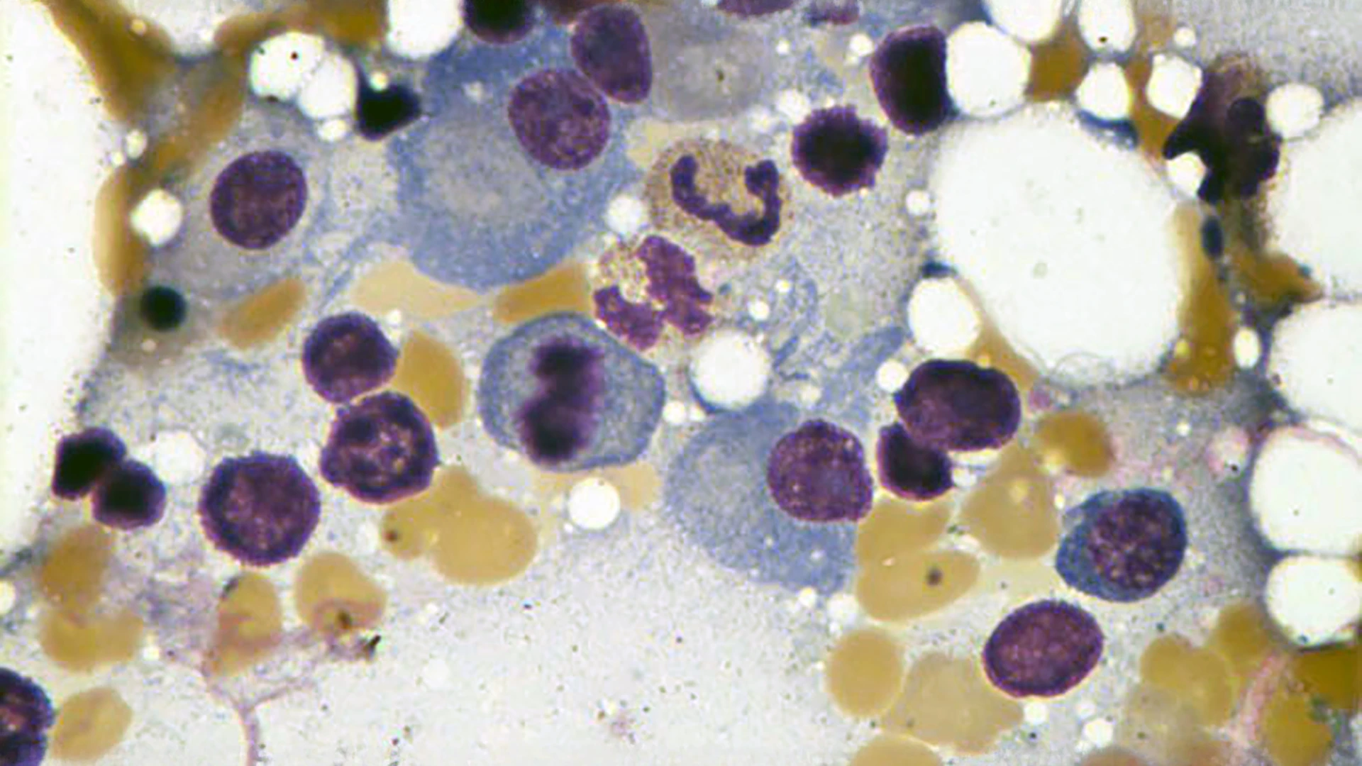 Mount Sinai Tisch Cancer Center 2026