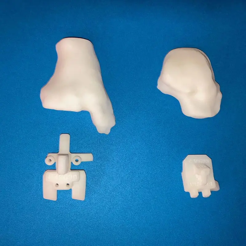 3D-printed tibia and talus based on preoperative CT scan (top) and 3D-printed jigs for tibia and talar cutting guides for total ankle arthroplasty (bottom).