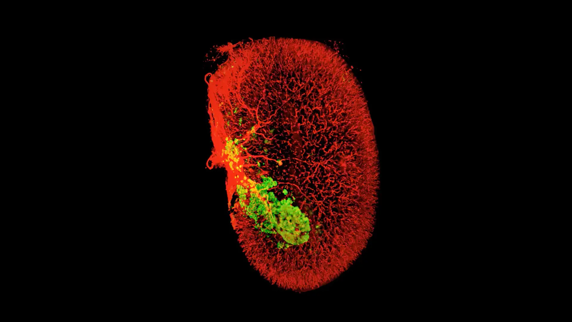 A Combination Treatment, Including Harmine, Can Increase Human Insulin-Producing Cells in Vivo