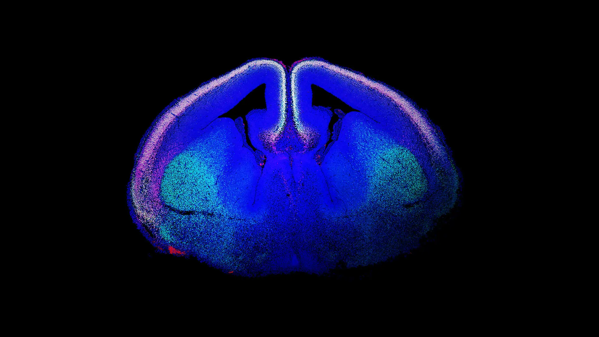 How Advances in Genetics, Stem Cell Biology, and Imaging Are Unveiling the Mysteries of Brain Development 