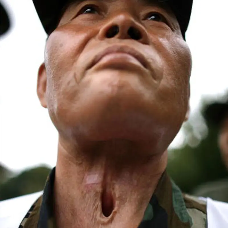 About 350,000 South Korean soldiers fought side-by-side with U.S. troops during the Vietnam War, 150,000 of which say they were exposed to Agent Orange. [Photo by Chip Somodevilla/Getty Images]