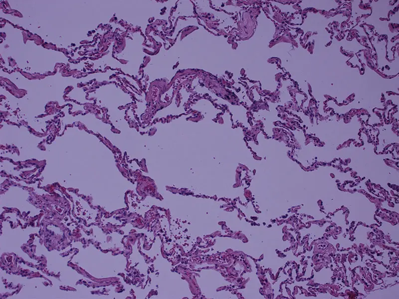 pulmonary vessel histology