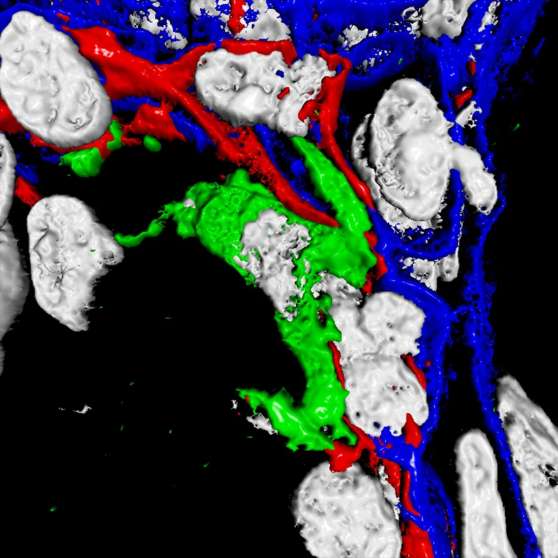 3D image rendering of an immune cell (green) interacting with heterogenous glandular cells (red and blue). Nuclei of cells (white).