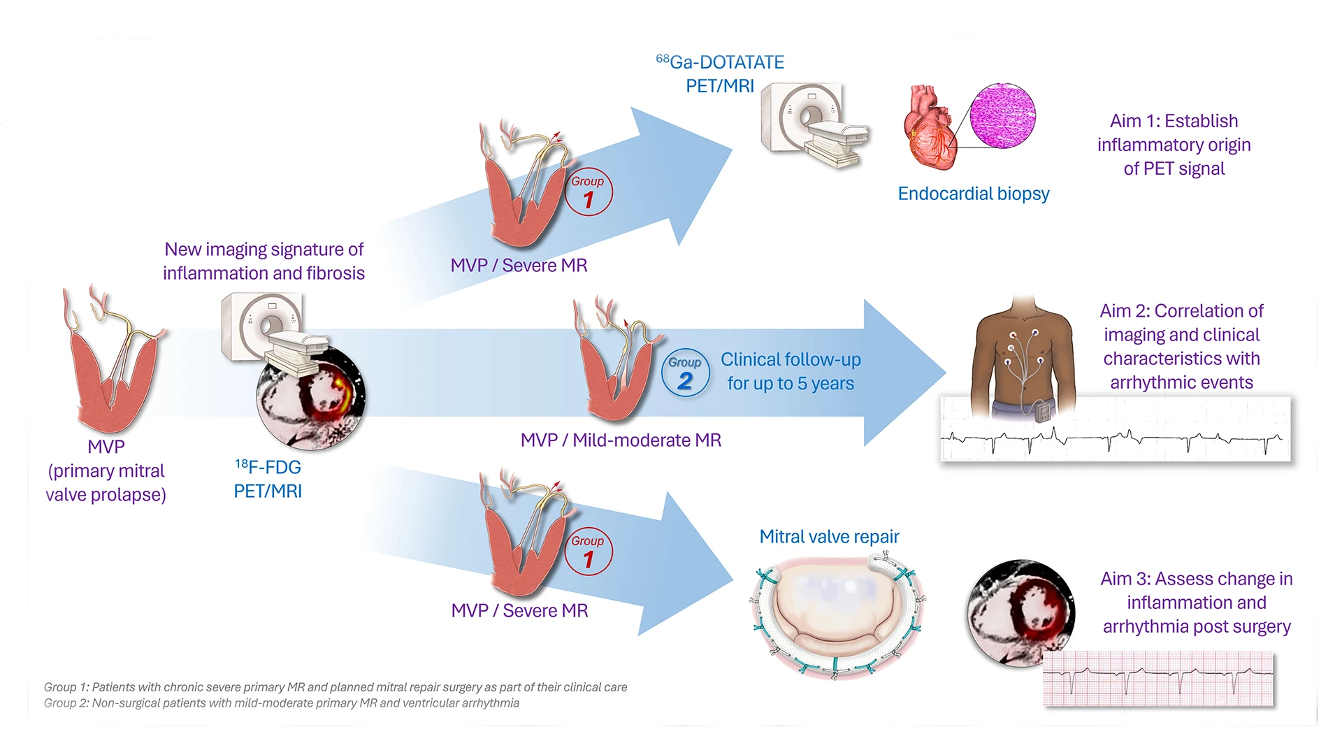 An abstract of the mitral valve prolapse research grant proposal.