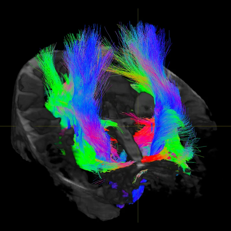 Figure 1. Diffusion MRI at 7T allows for the study of hippocampal subfield specific tracts in a living human subject.