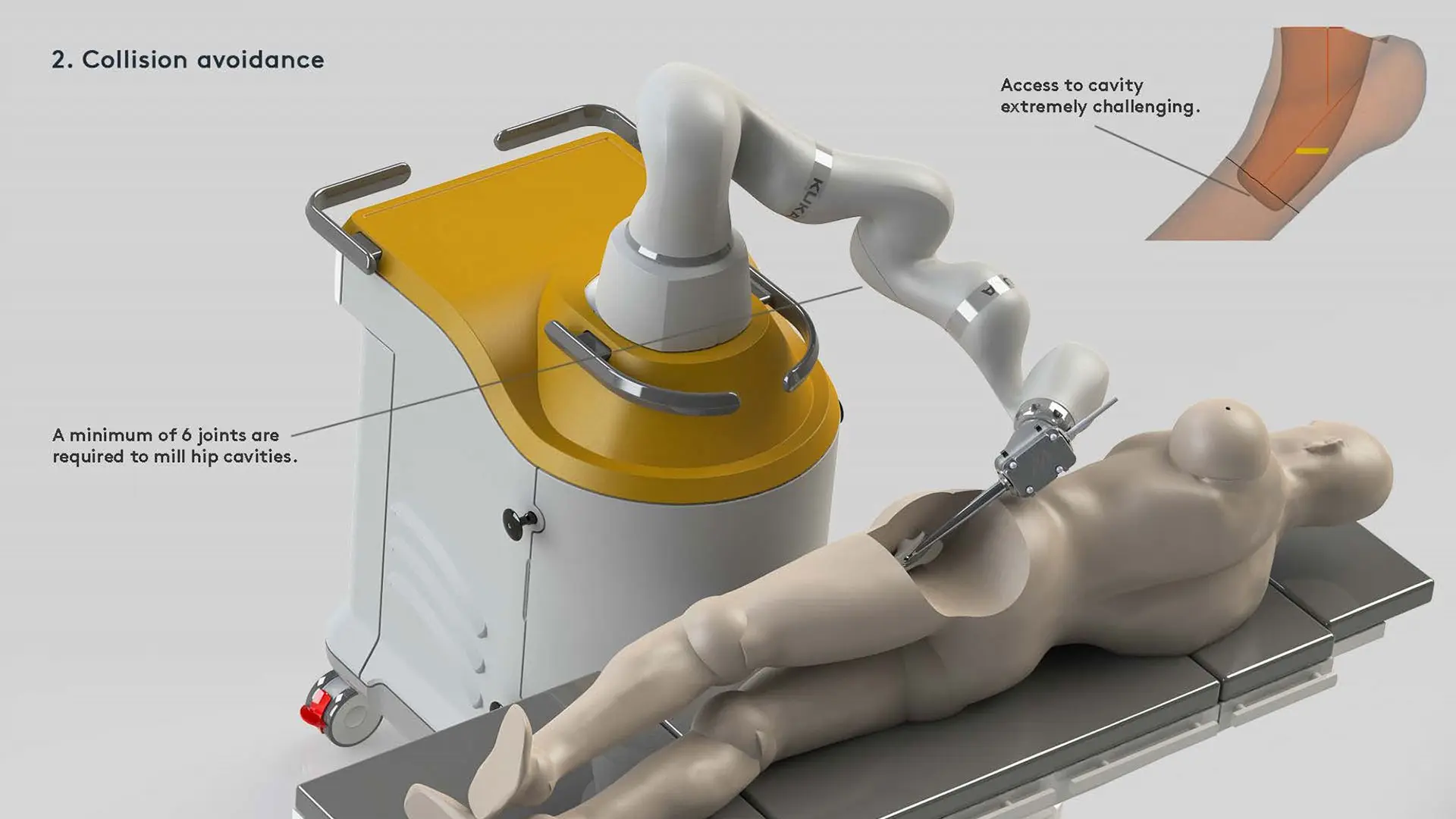 Closer examination of Monogram Robotic System SOURCE: Monogram Orthopedics