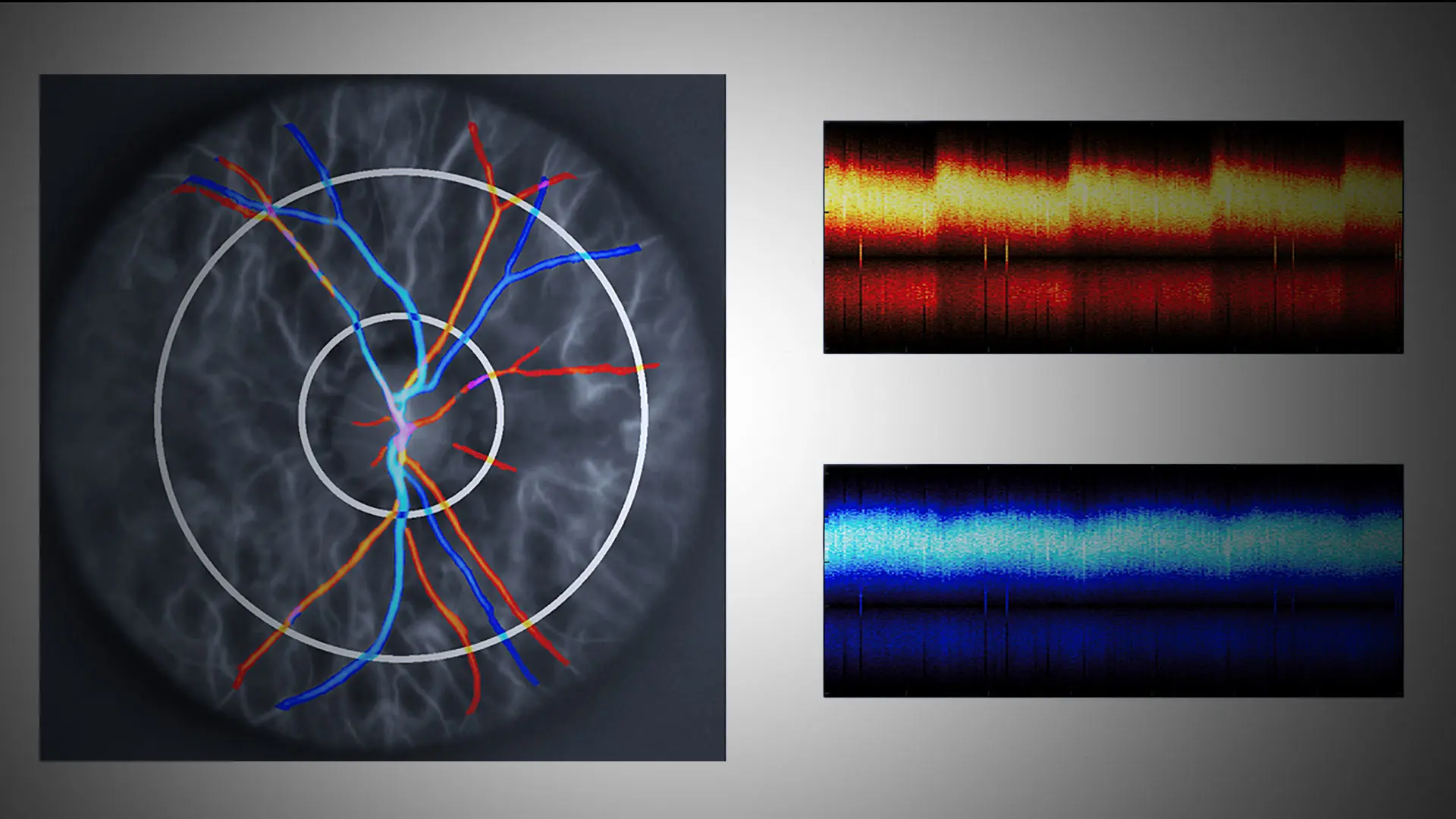 Painting a Clearer Picture of Blood Flow Dynamics With Doppler Holography