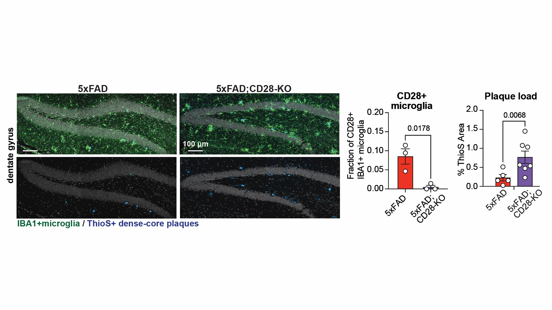Figure 4. Identification of an immunoregulatory neuroprotective microglia may open new path for immunotheraphy approaches in AD. A small CD28-expressing microglial population controls brain-wide microglial inflammation and slows the buildup of amyloid plaques. Genetic deletion of CD28 from microglia (CD28-KO, right image and purple bar graphs) in a mouse model of the disease (5xFAD) increases microglia (green) inflammatory activity and plaque (blue) formation in mice. Quantifications are shown on the right.