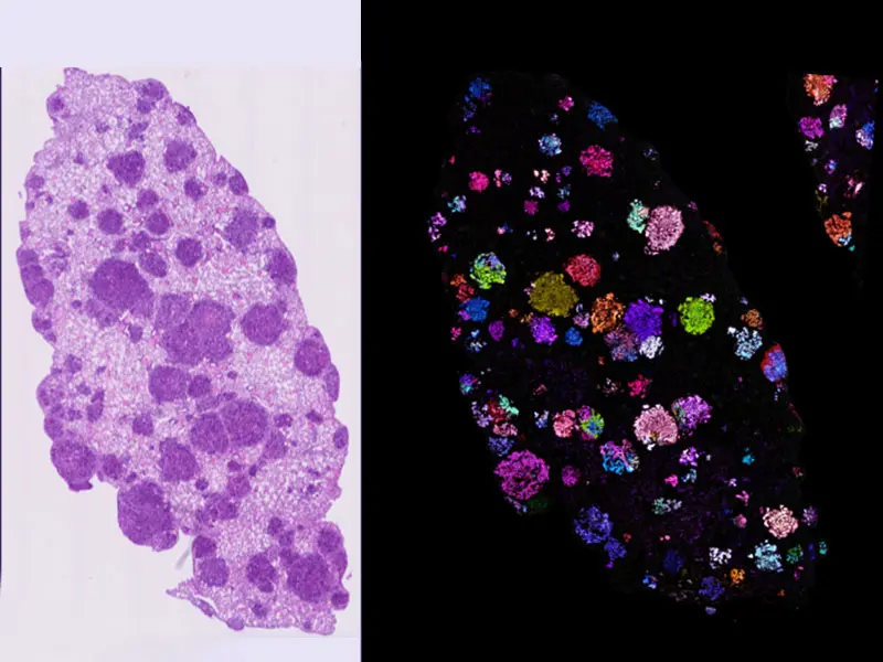 Pro-Code spatial mapping of KP lung tumors indicates lesions are highly clonal. 