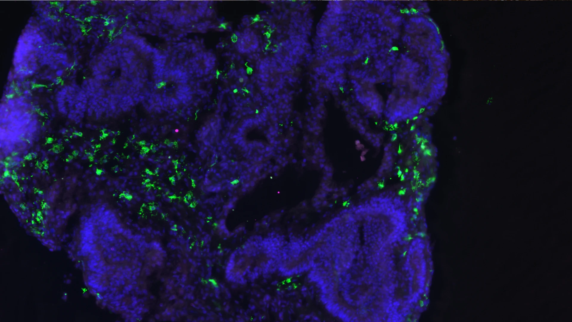 An organoid from Dr. De Witte’s lab, with the microglia shown in green. Image courtesy of Ormel PR et al., via Nature Communications.