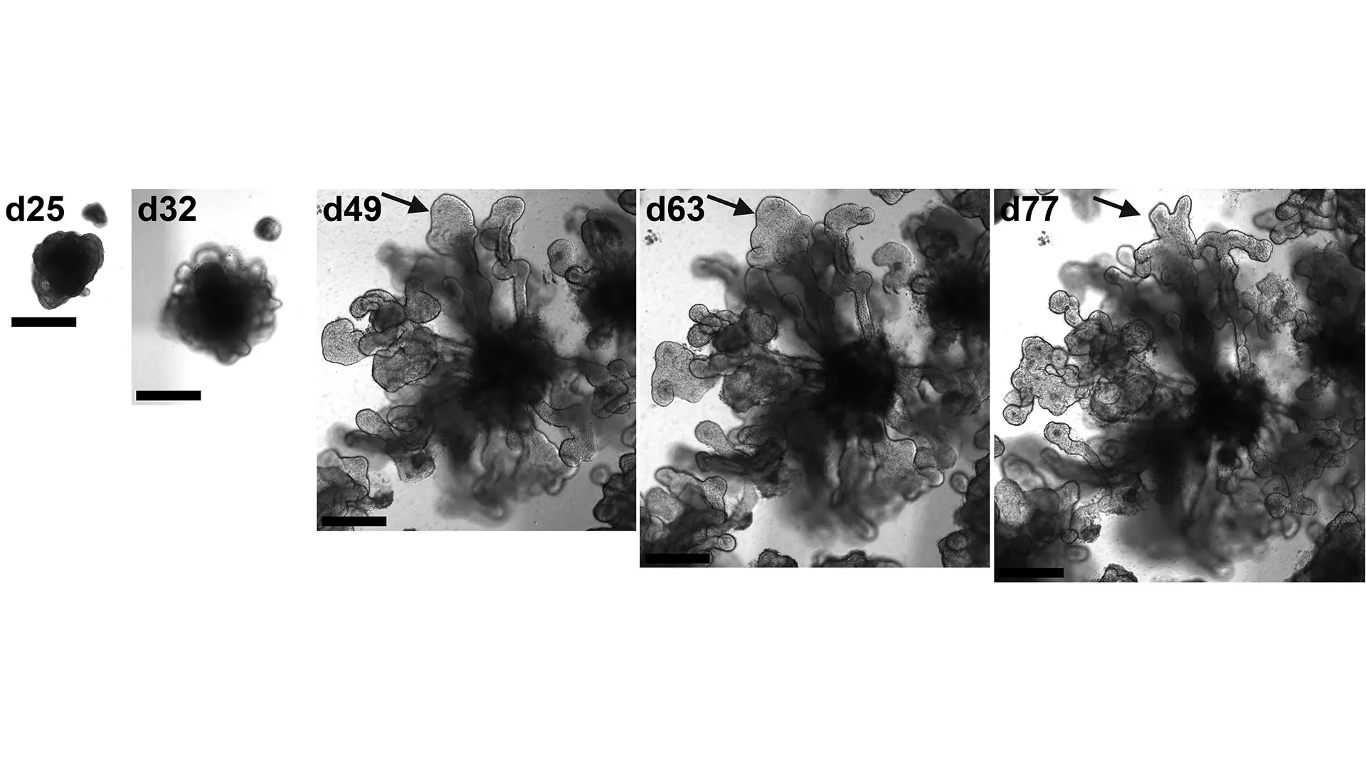 Bright field images of the development of a lung organoid into a branching structure. The arrow indicates a branching tip that is bifurcating. 