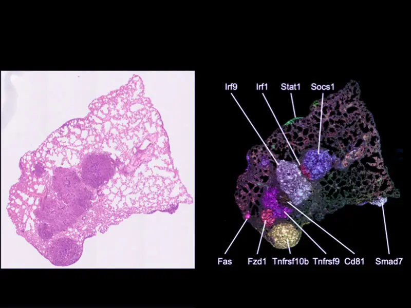Spatial mapping of Pro-Code/CRISPR tumor lesions.  