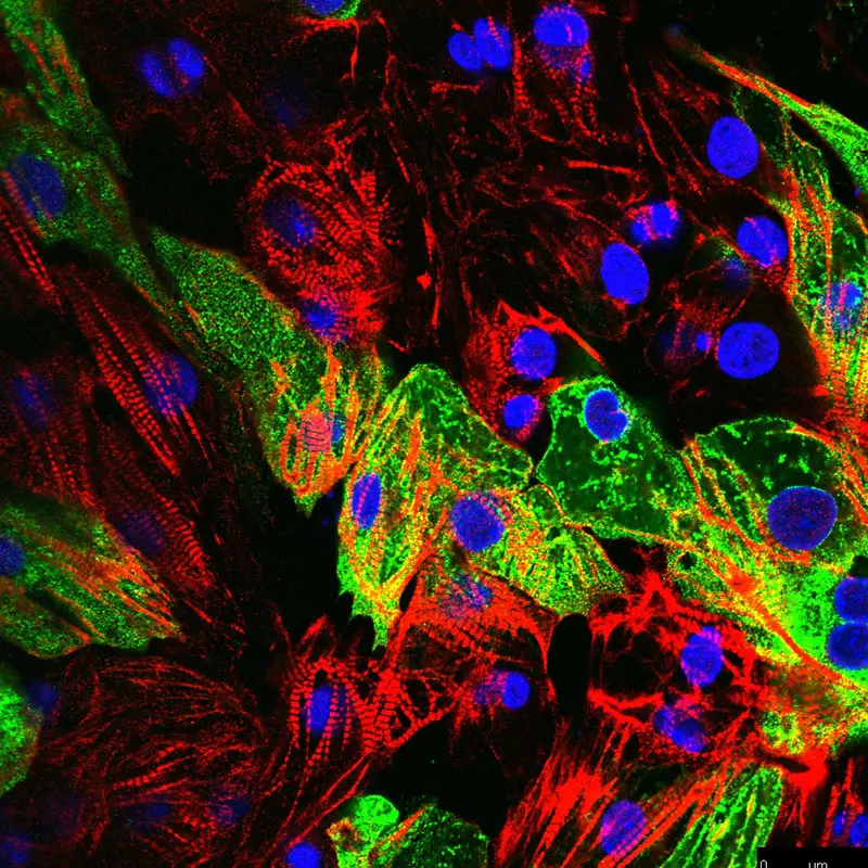 Dr. Kontorovich is also investigating the role of human genetics in cardiac susceptibility to myocarditis after exposure to the COVID-19 virus. Above, the viral uptake in heart cells 48 hours after infection is shown in green.





