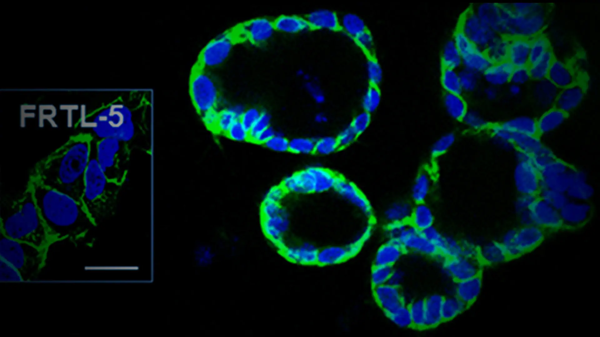 Pluripotent Human Stem Cells Show Potential for Thyroid Regenerative Therapy