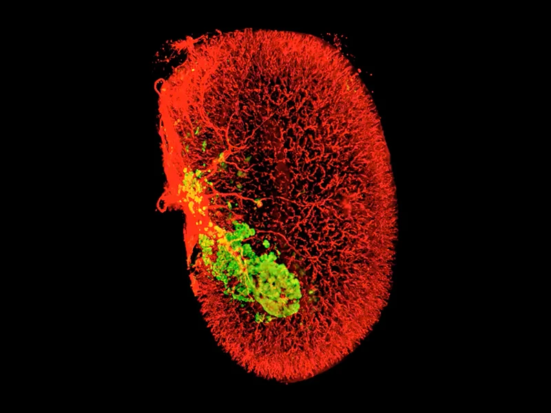 A 3D image of beta cells (green) in one human islet graft (smooth muscle actin, red) harvested from an untreated mouse 2 weeks after transplantation