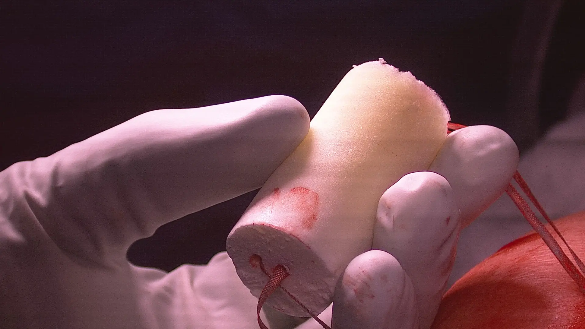 A surgeon prepares a BEAR Implant prior to surgery.